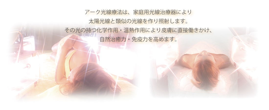 アーク光線